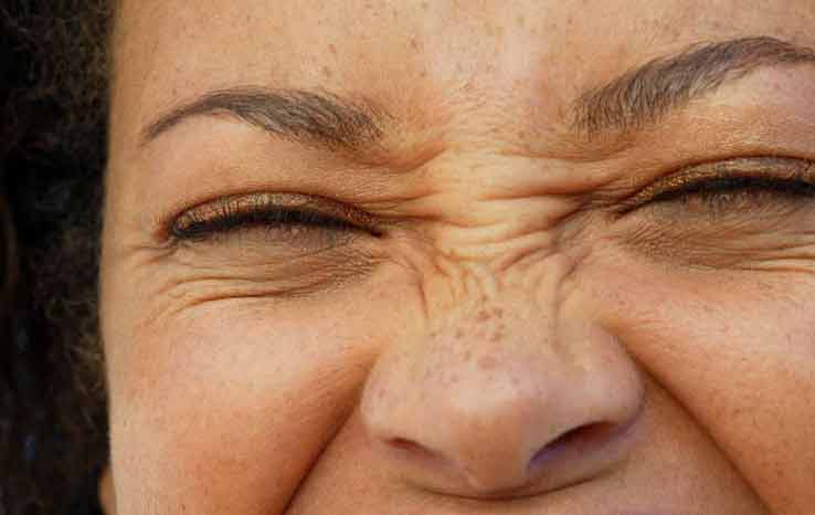 Bunny Lines Botulinum Toxin Treatment (鼻樑上的皺紋)Recommended by Dr. Yeung Ho Hong 楊浩康