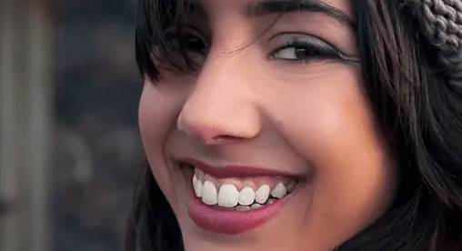 Gummy Smile Botulinum Toxin Treatment (露齦笑/笑齦)Recommended by Dr. Yeung Ho Hong 楊浩康